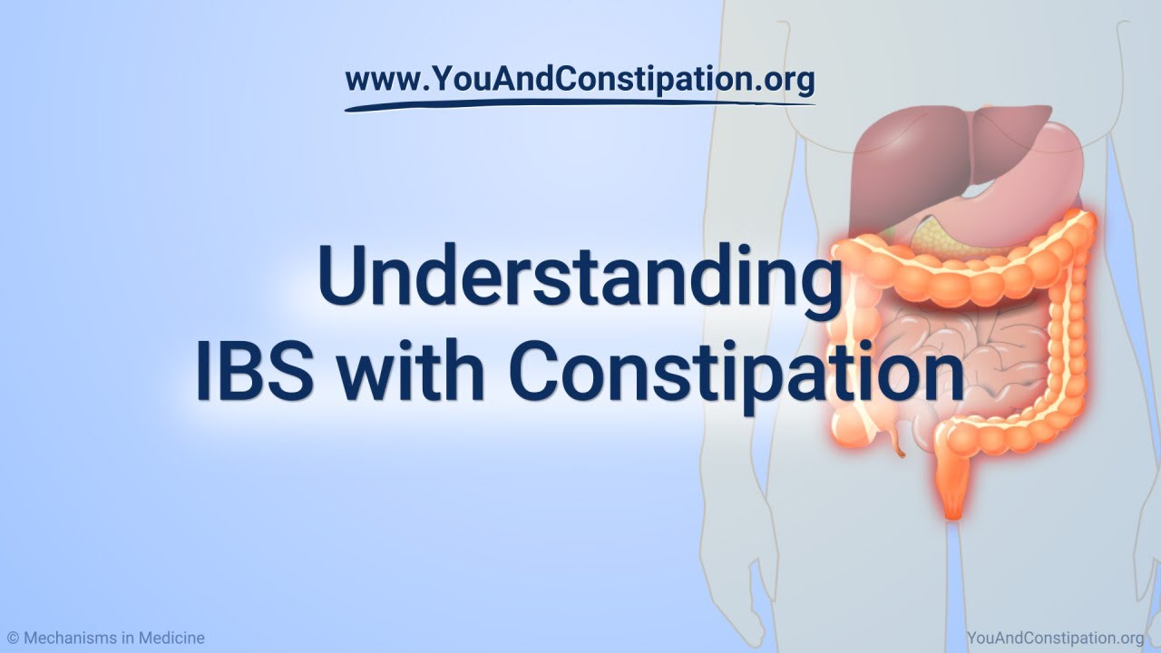 understanding ıbs with constipation