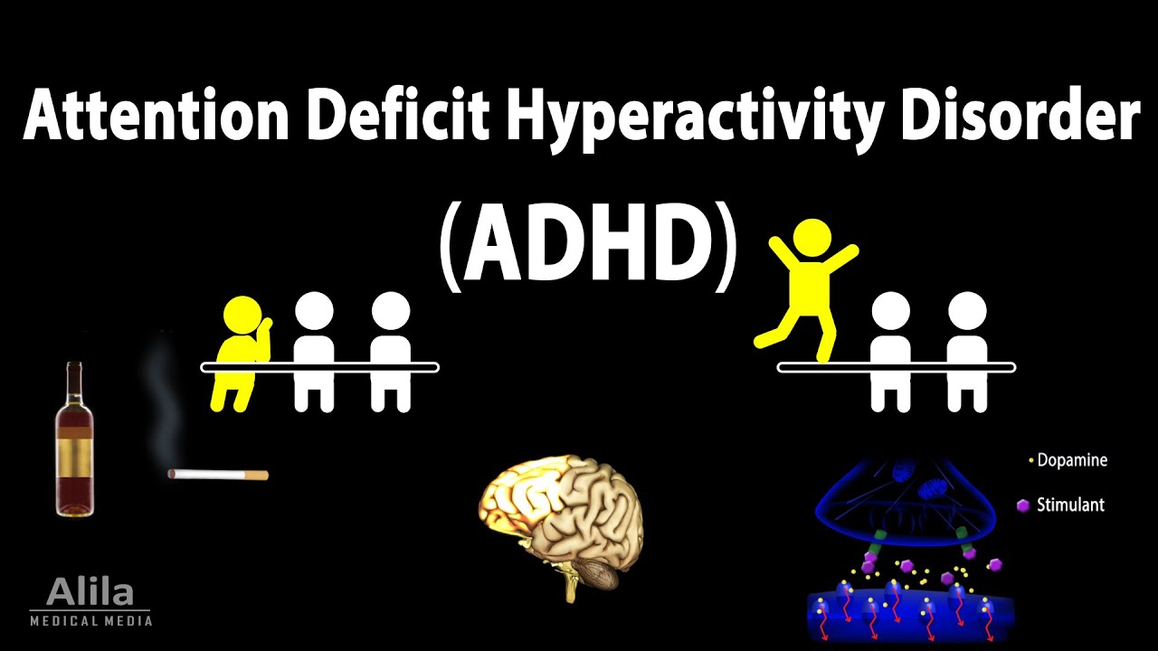 Attention Deficit Hyperactivity Disorder (ADHD), Animation