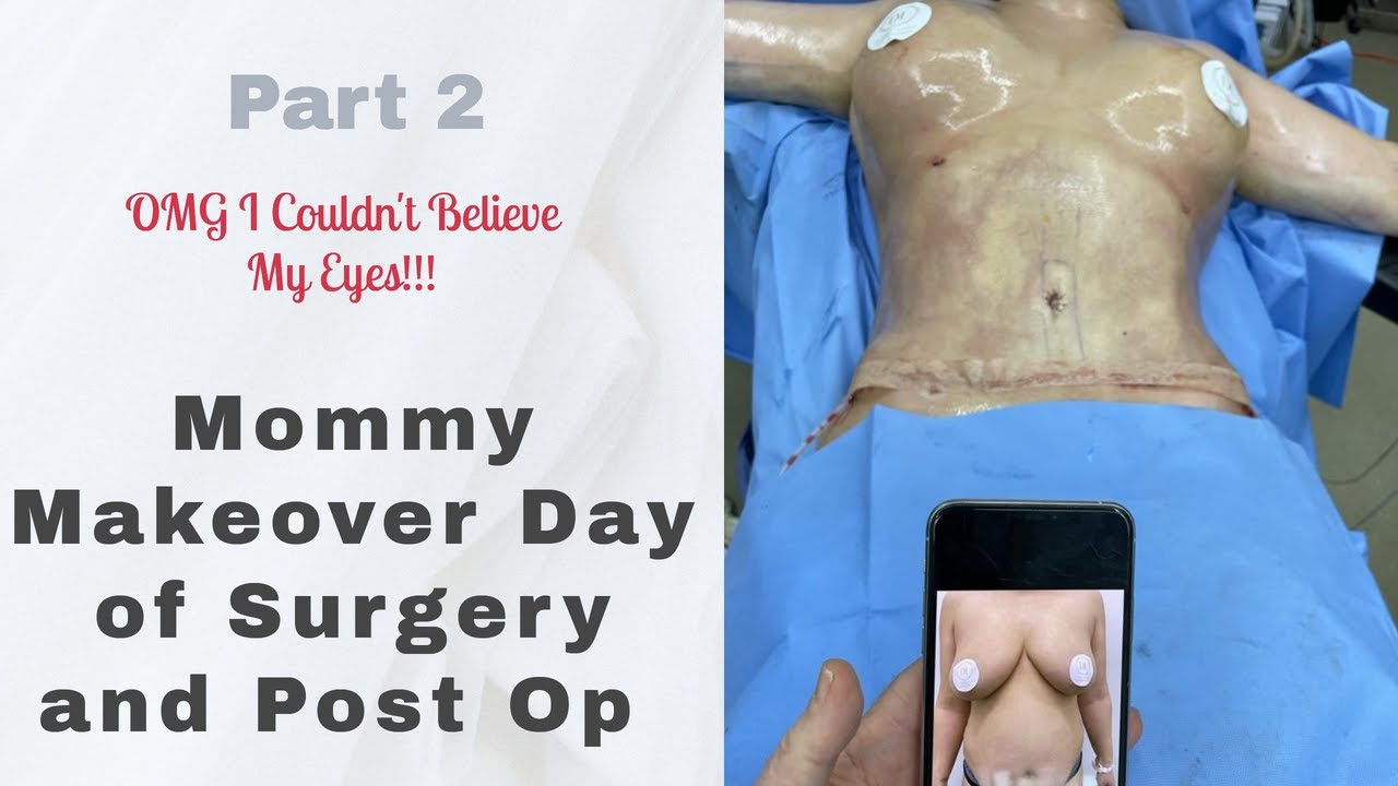 Mommy Makeover Day of Surgery and Post Op 2021