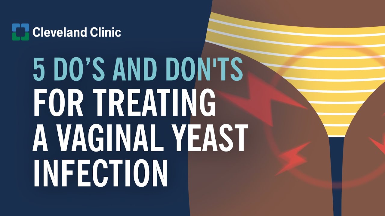 HOW TO TREAT A YEAST INFECTİON