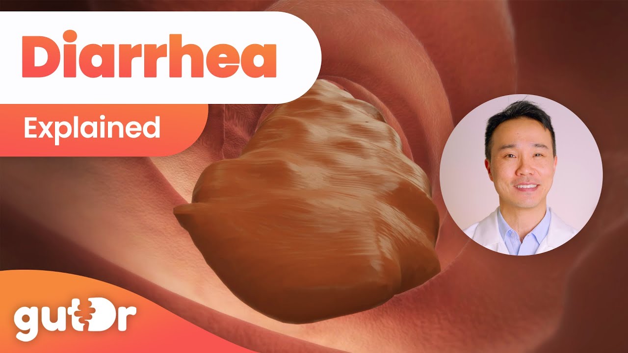 Diarrhea | Explained by Dr. Vincent Ho (3D Gut Animation)
