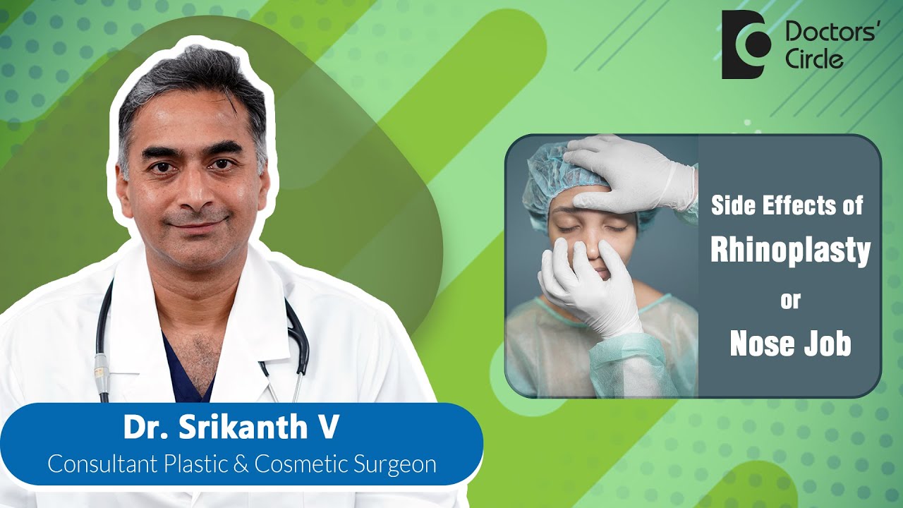 Side Effects Of Rhinoplasty (Nose Job) #plasticsurgery #rhinoplasty -Dr. Srikanth V| Doctors' Circle