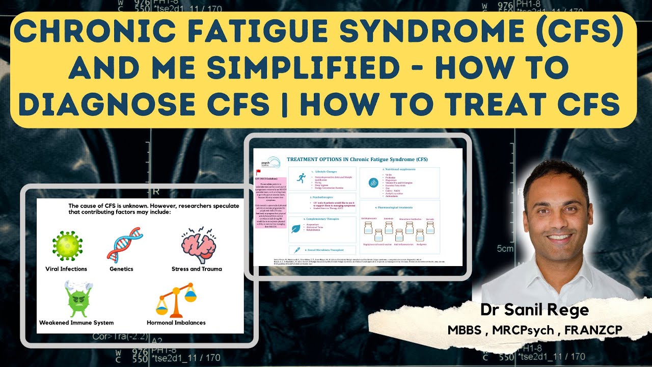CHRONİC FATİGUE SYNDROME AND ME SİMPLİFİED - HOW TO DİAGNOSE AND TREAT CFS | A PSYCHİATRİST EXPLAİNS