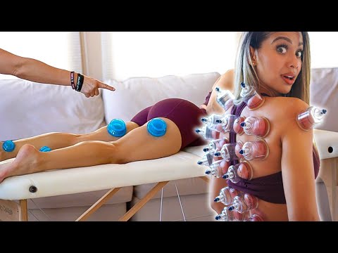 2 gırls 20 cups (painful cupping therapy)