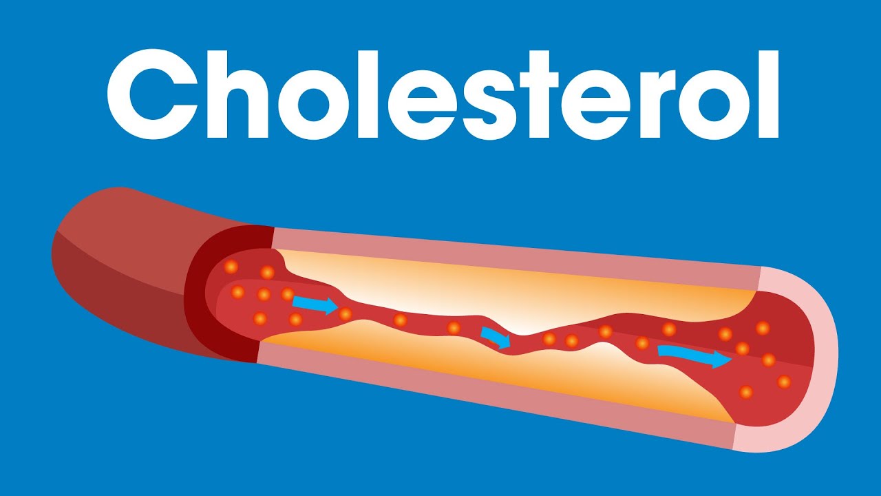 What Is Cholesterol? | Munson Minutes