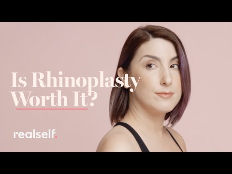 Everything you need to know about rhinoplasty