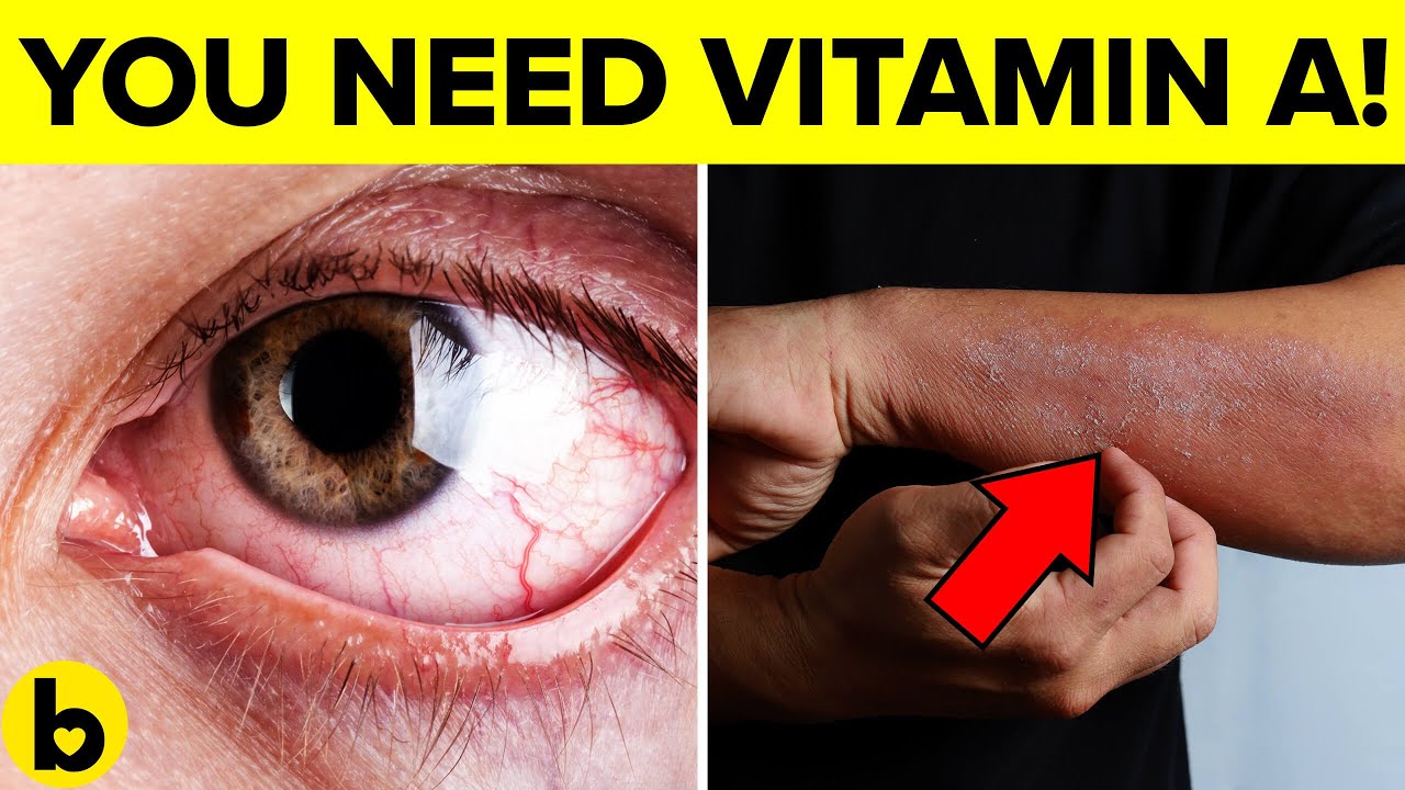 7 signs your body ıs desperate for vitamin a