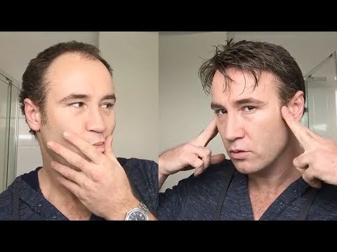 Video 24: A beginner's guide to prosthetic hair