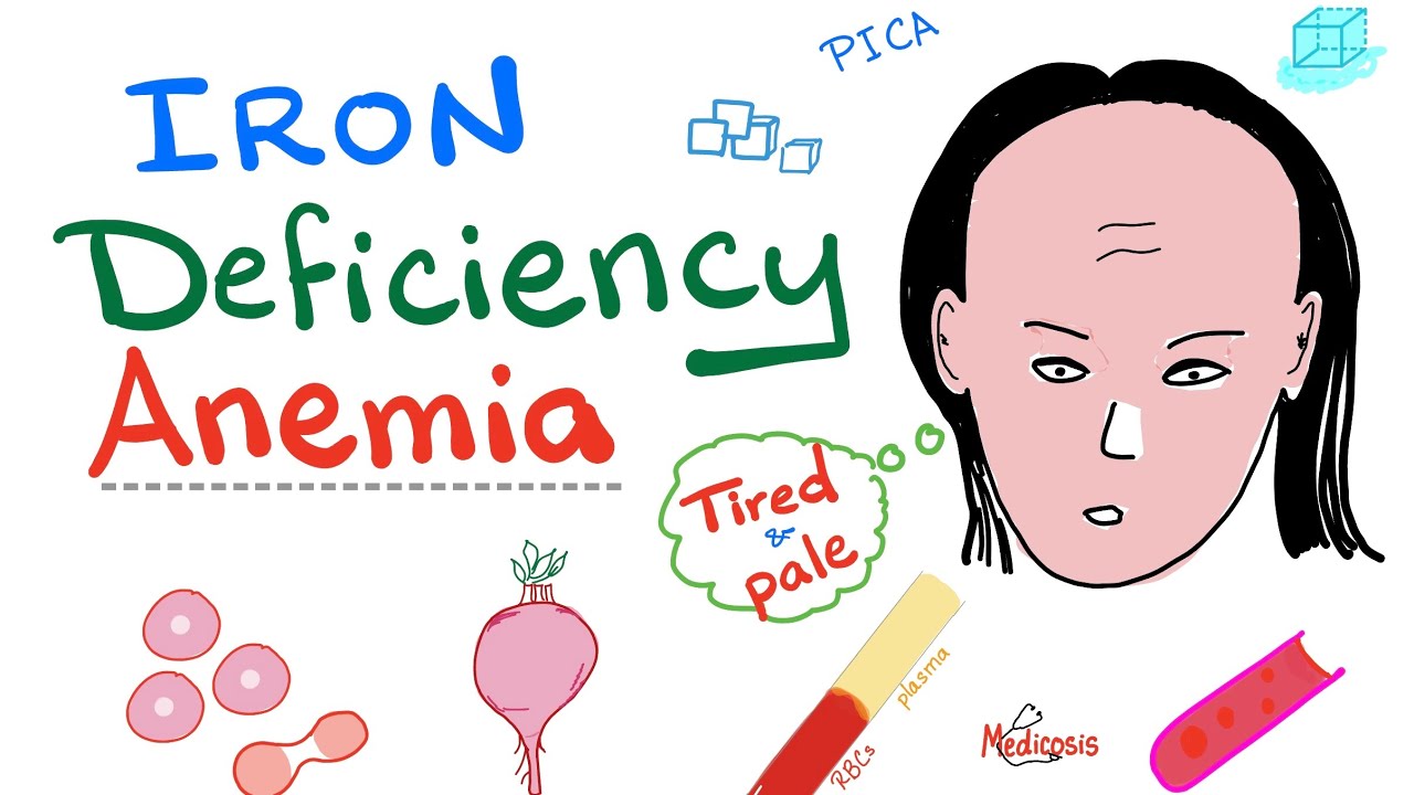 Iron Deficiency Anemia   All you need to know   Causes  Symptoms  Diagnosis  Treatment