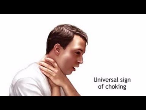 How to perform the Heimlich Maneuver