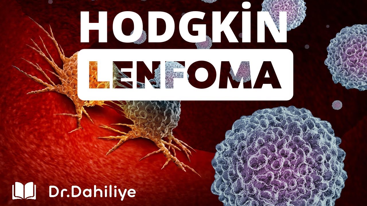Hodgkin Lenfoma | Fizyolojiden Tedaviye