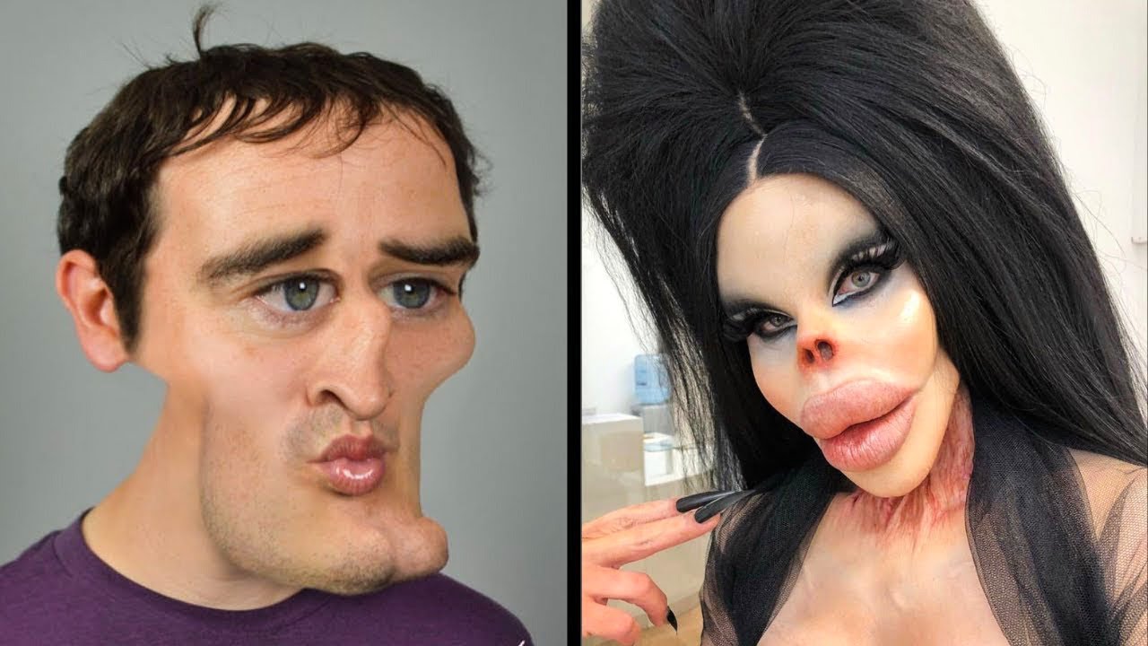 Before and After Plastic Surgery   Supermodel Pixee Fox's Aesthetic Disaster