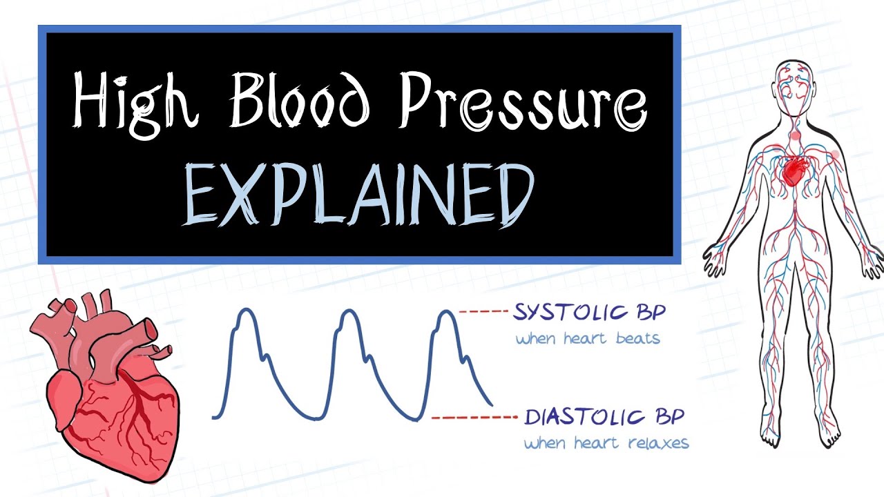 WHAT İS HİGH BLOOD PRESSURE? (HEALTHSKETCH)