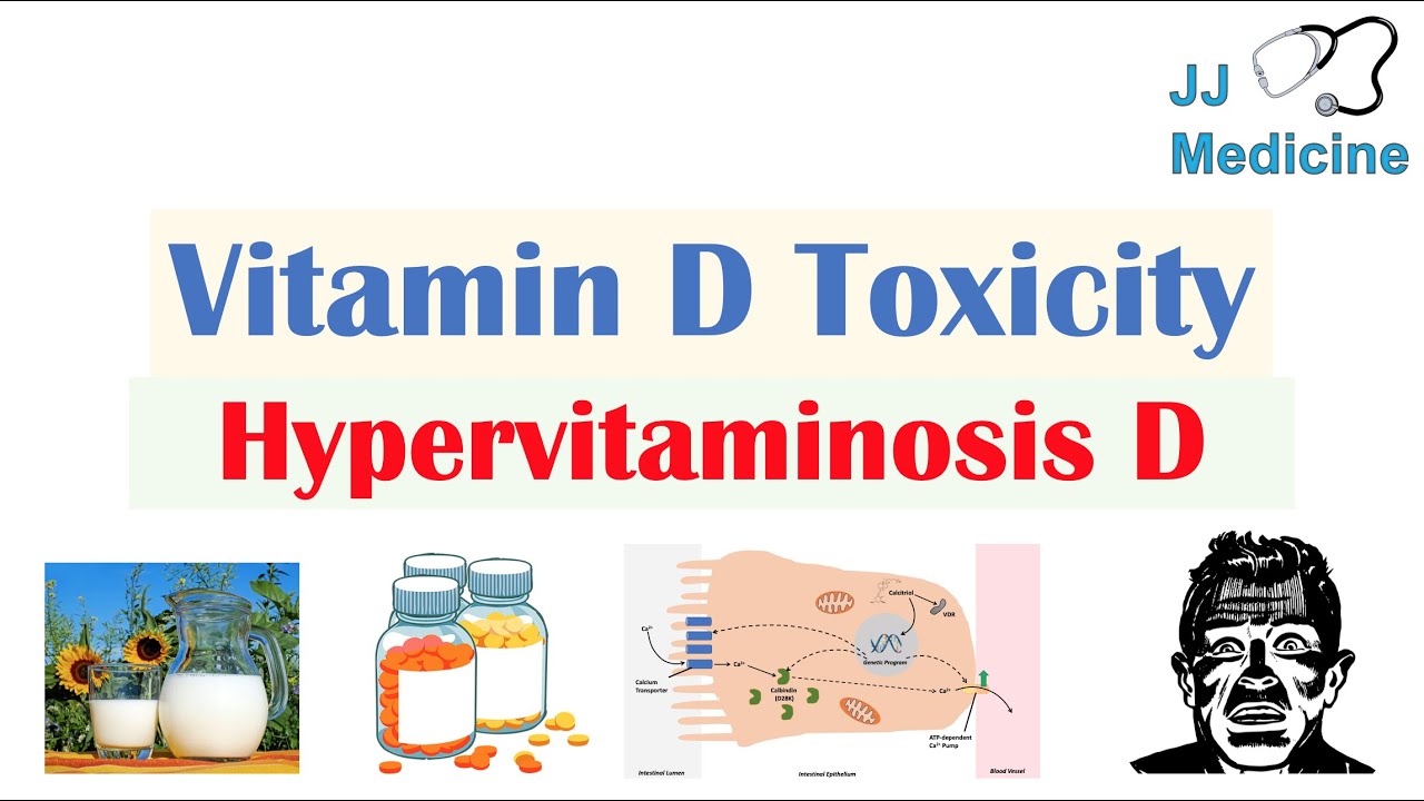 Vitamin D Toxicity (Hypervitaminosis D) | Causes, Pathophysiology, Symptoms, Diagnosis, Treatment
