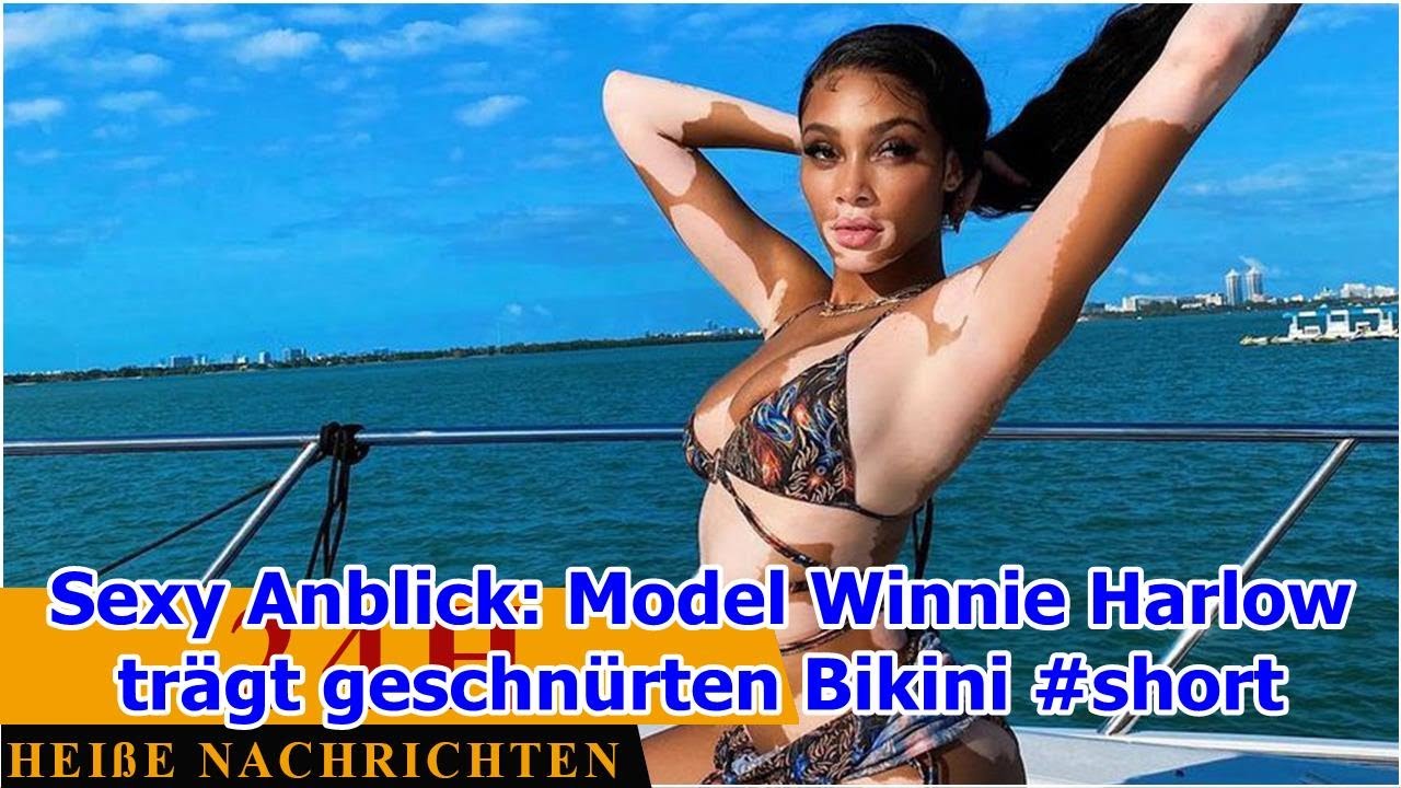 Sexy Anblick: Model Winnie Harlow trägt geschnürten Bikini #short