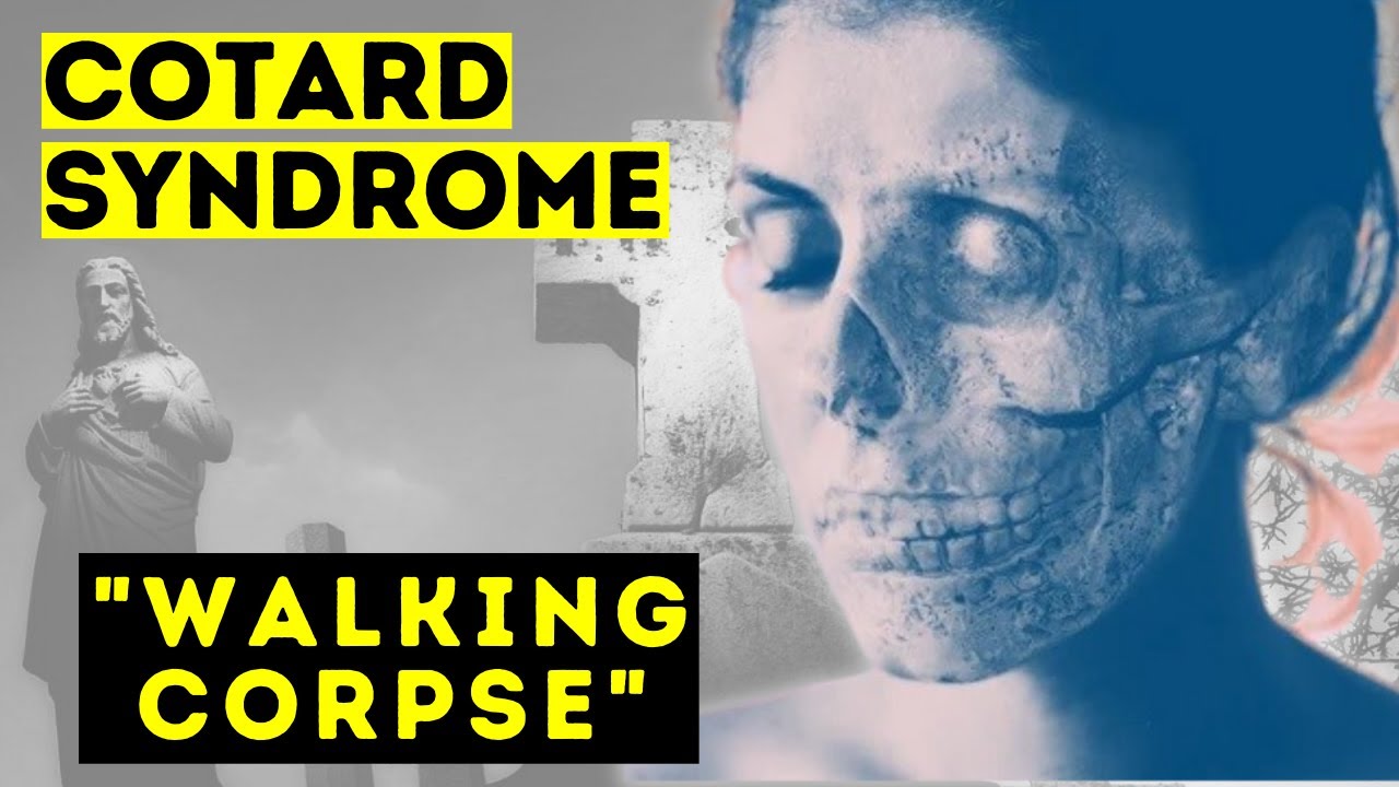 COTARD SYNDROME - WALKİNG CORPSE SYNDROME – WHAT İS İT? SHORT DOCUMENTARY