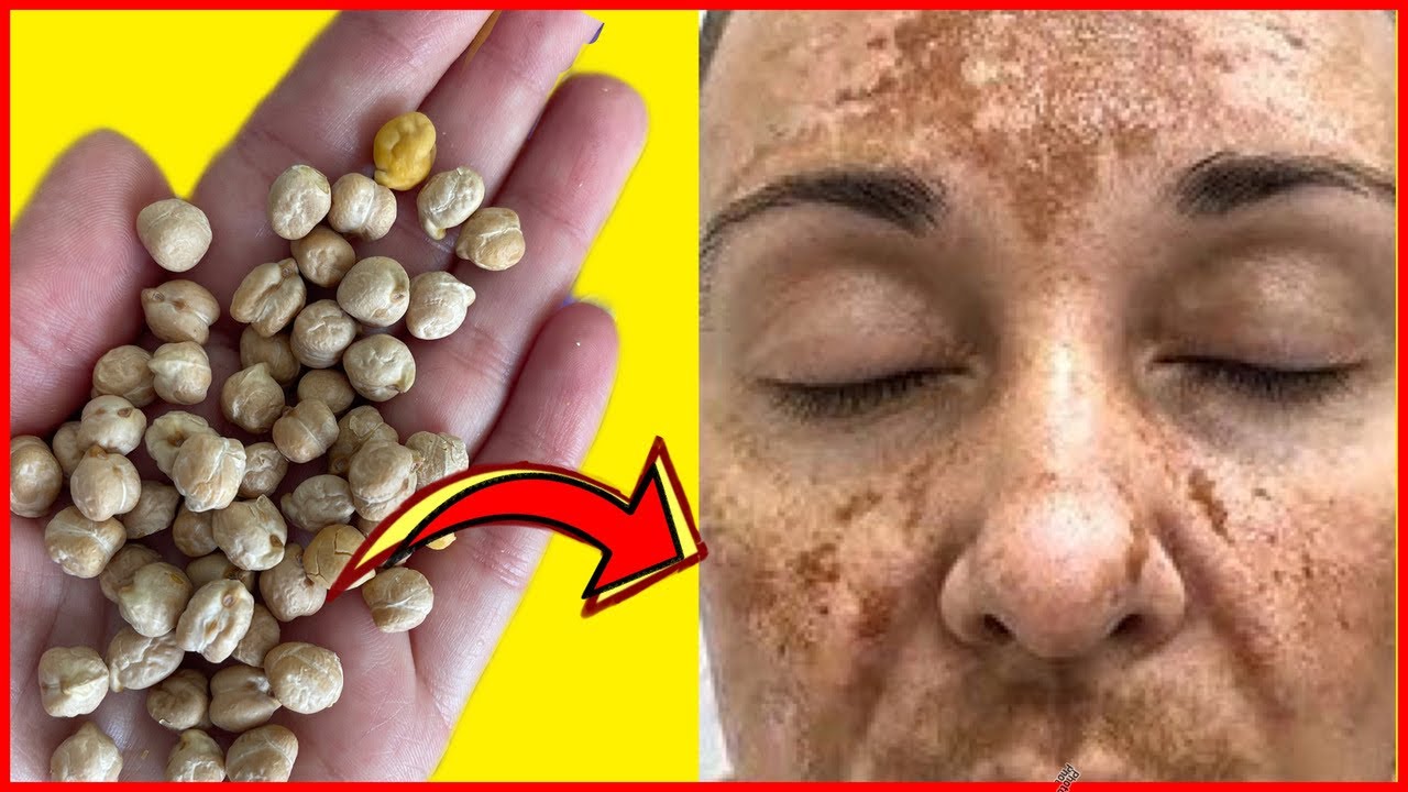 WIPE OFF FACIAL BLEMISHES WITH 1 HANDFUL OF CHICKPEAS ! THE MIRACLE MASK WIPING AGE SPOTS, WRINKLES