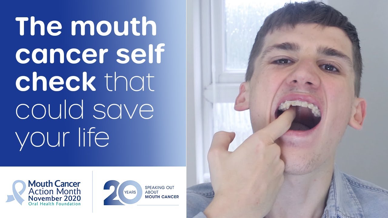 HOW TO DO A MOUTH CANCER CHECK AT HOME