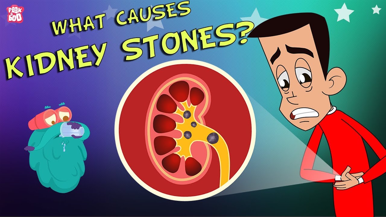 WHAT CAUSES KİDNEY STONES? | THE DR. BİNOCS SHOW | BEST LEARNİNG VİDEOS FOR KİDS | PEEKABOO KİDZ