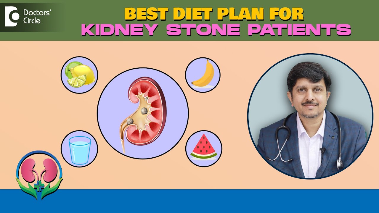 KIDNEY STONE DIET PLAN AND PREVENTİON | FOOD TO EAT AND AVOİD - DR.SANJAY PANİCKER | DOCTORS' CİRCLE