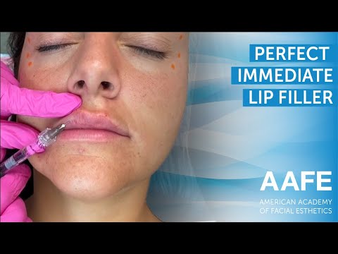 perfect ımmediate lips - lip filler