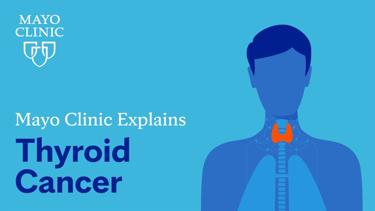 Mayo Clinic explains thyroid cancer