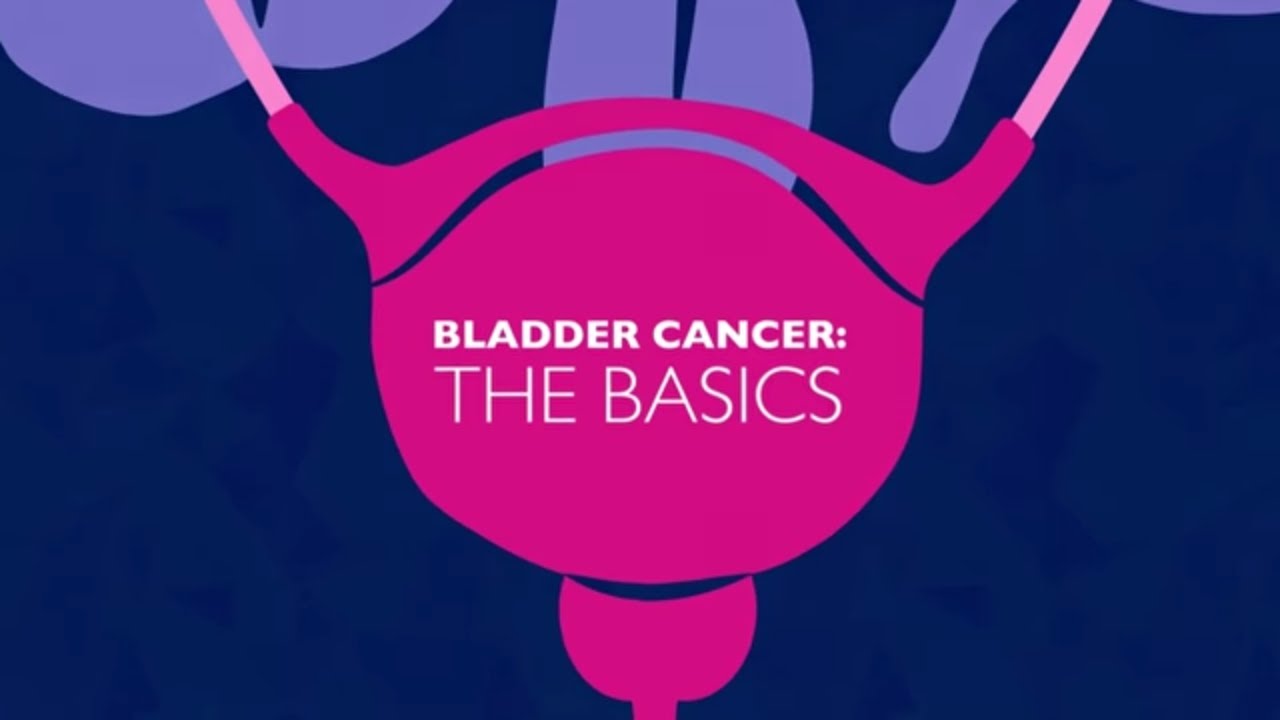 BLADDER CANCER: THE BASİCS | JOHNS HOPKİNS GREENBERG BLADDER CANCER INSTİTUTE