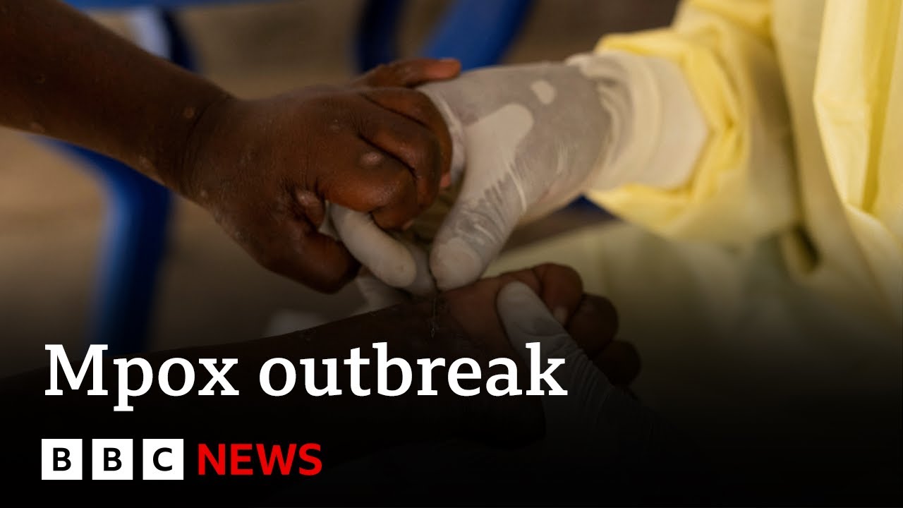 mpox-declared-public-health-emergency-in-africa