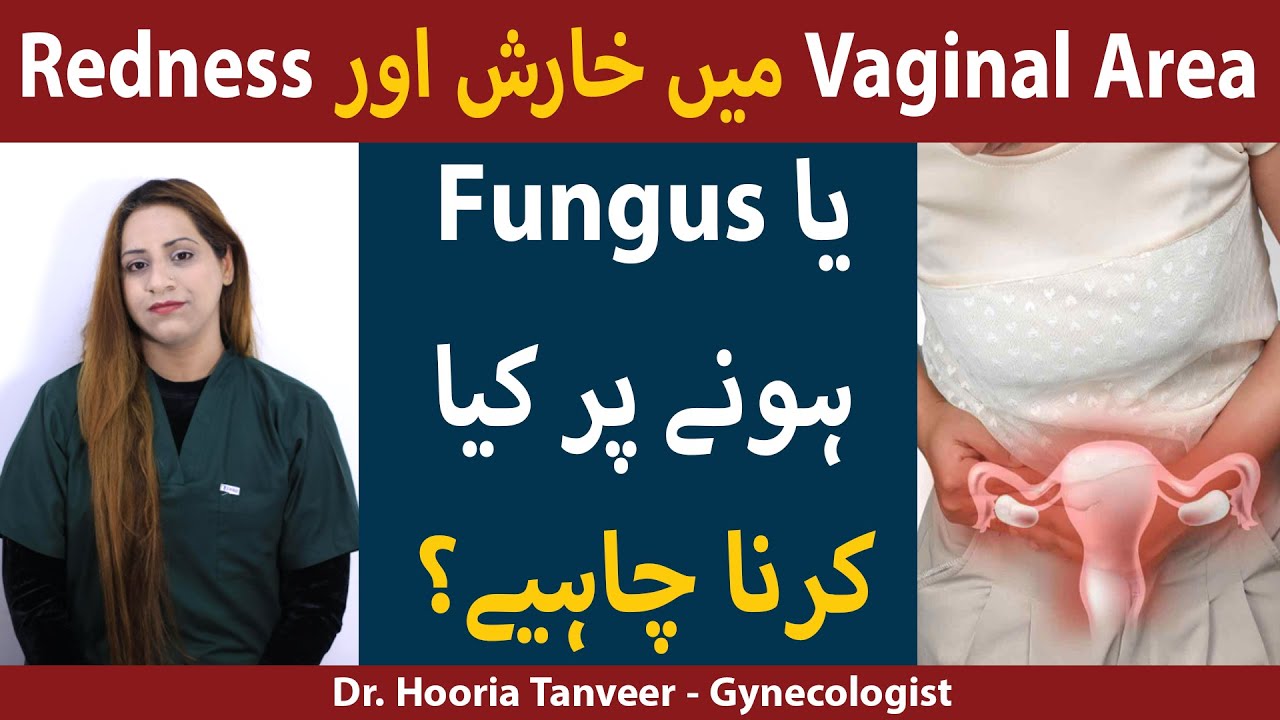 Vaginal Infection Treatment | Vagina Ma Kharish Ka Ilaj | How To Treat Vaginal Fungal Infection