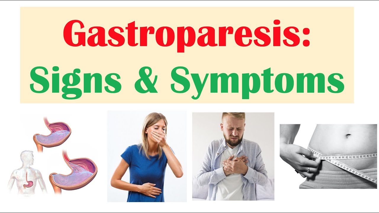 GASTROPARESİS SİGNS  SYMPTOMS (EX. NAUSEA, ABDOMİNAL PAİN, WEİGHT LOSS)