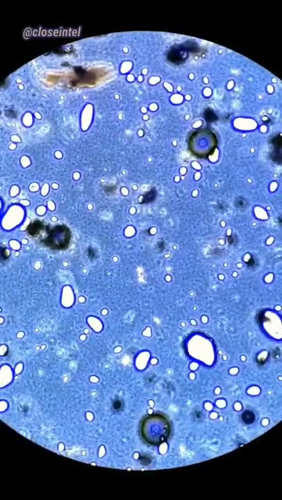 Probiotic Capsules Under Microscope (Do Dry Probiotics Work?)