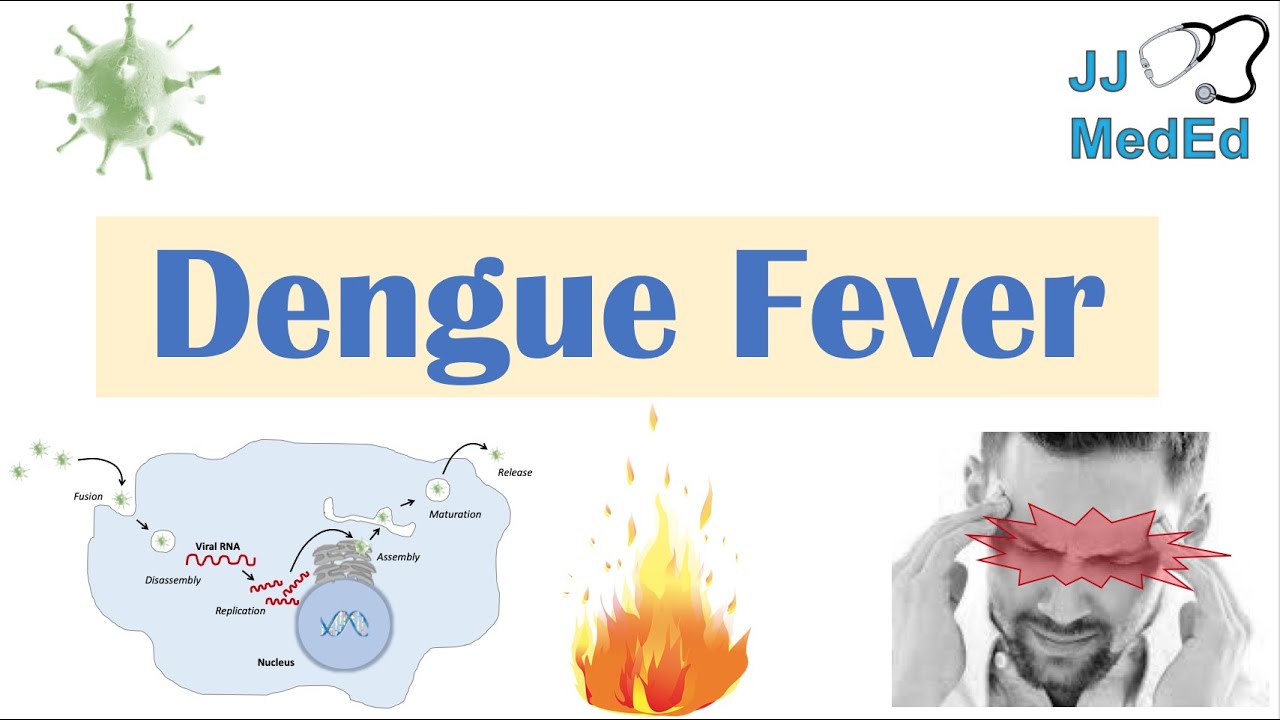 Dengue Fever | Pathophysiology, Symptoms, Diagnosis  Treatment