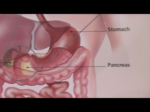 ırritable bowel syndrome  ıts symptoms