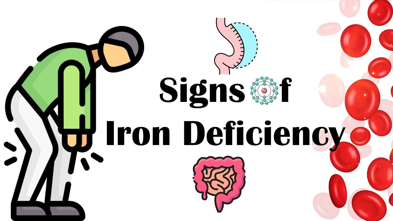 Signs Of Iron Deficiency  What Are The Signs   Symptoms Of Iron Deficiency Anemia  IDA 