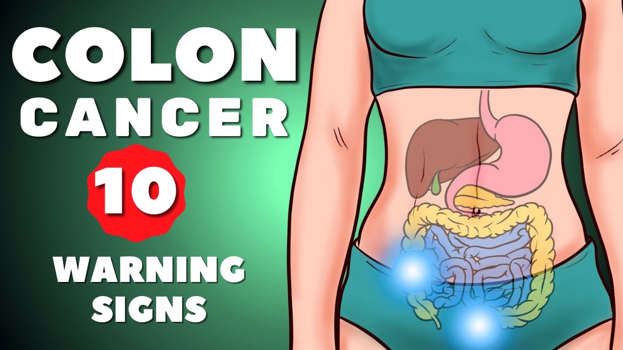 COLON CANCER SYMPTOMS | COLORECTAL CANCER | 10 WARNİNG SİGNS OF COLON CANCER | COLON CANCER
