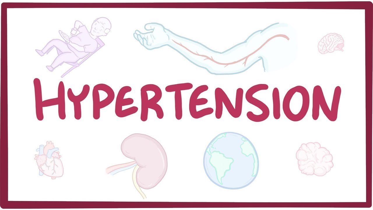 HYPERTENSİON- CAUSES, SYMPTOMS, DİAGNOSİS, TREATMENT, PATHOLOGY