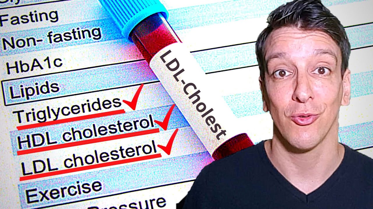 LDL CHOLESTEROL LEVEL: YOUR LAB RESULTS EXPLAİNED