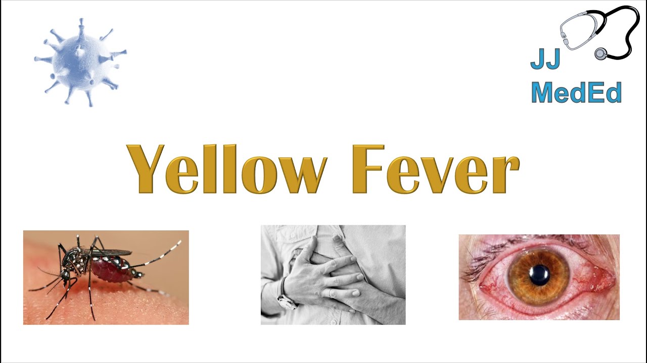 Yellow Fever | Pathogenesis (mosquitoes, virus), Signs  Symptoms, Diagnosis and Treatment