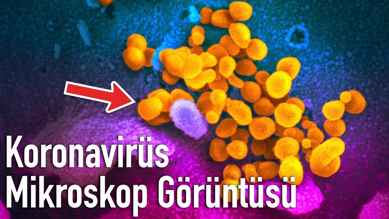 Hiç Gerçekte Bir Koronavirüs Gördünüz Mü?