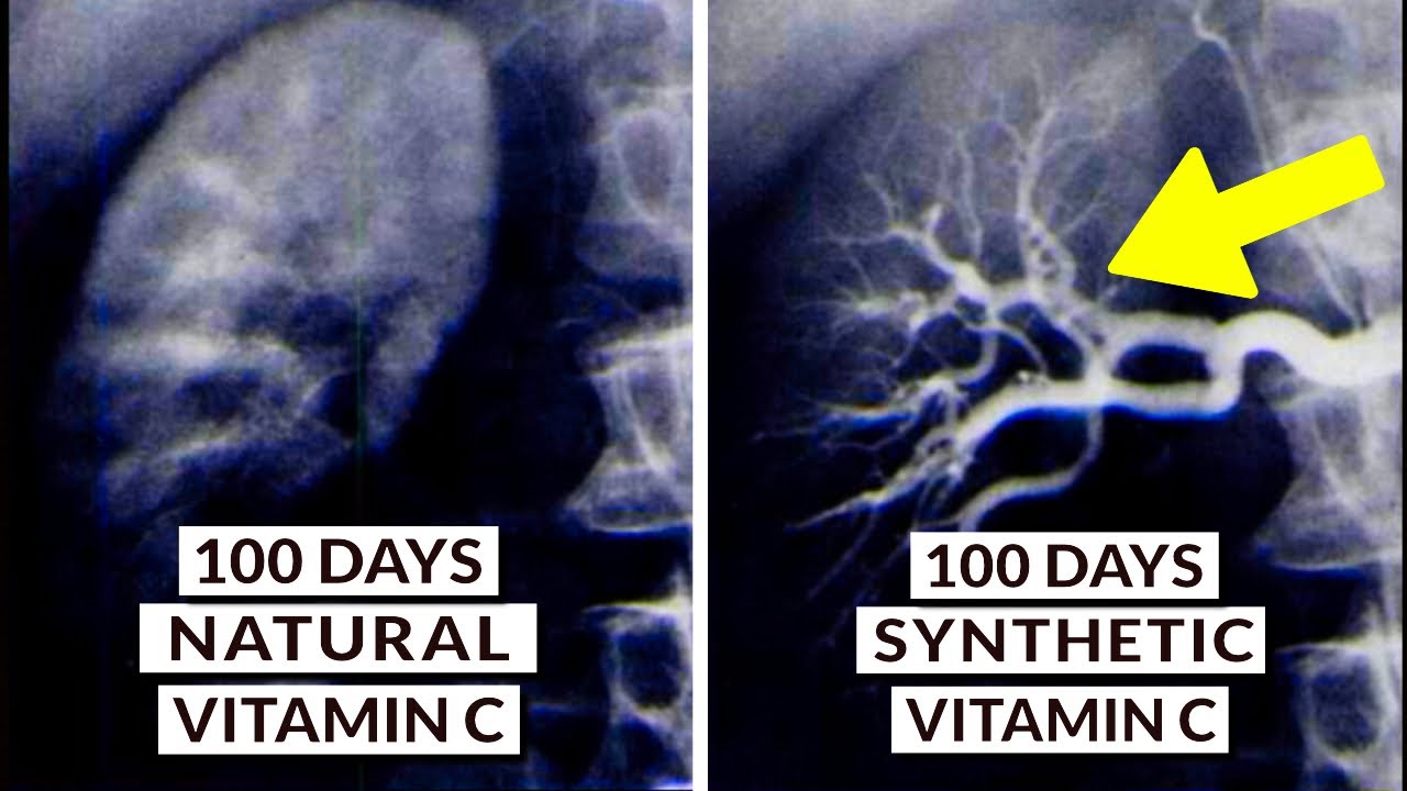 We Finally Know What Type Of Vitamin C Is Best