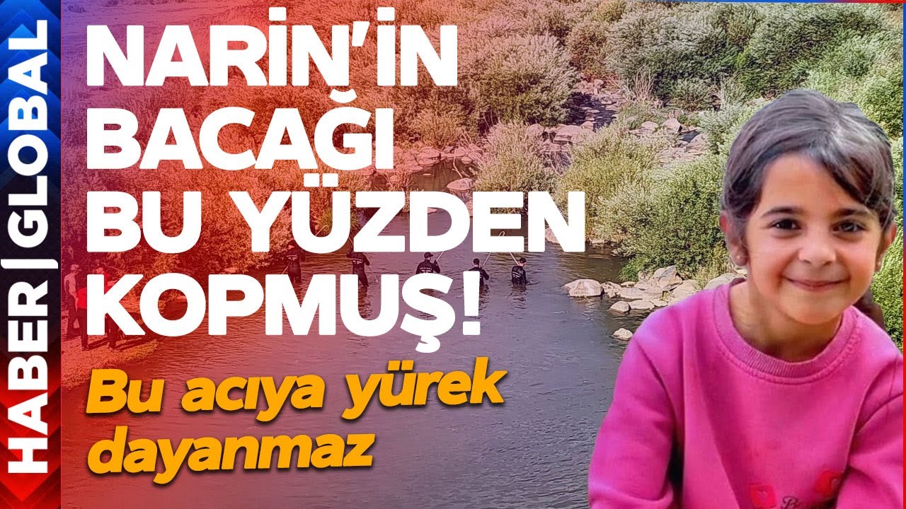 Narin Güran'ın Bacağı Bu Yüzden Kopmuş