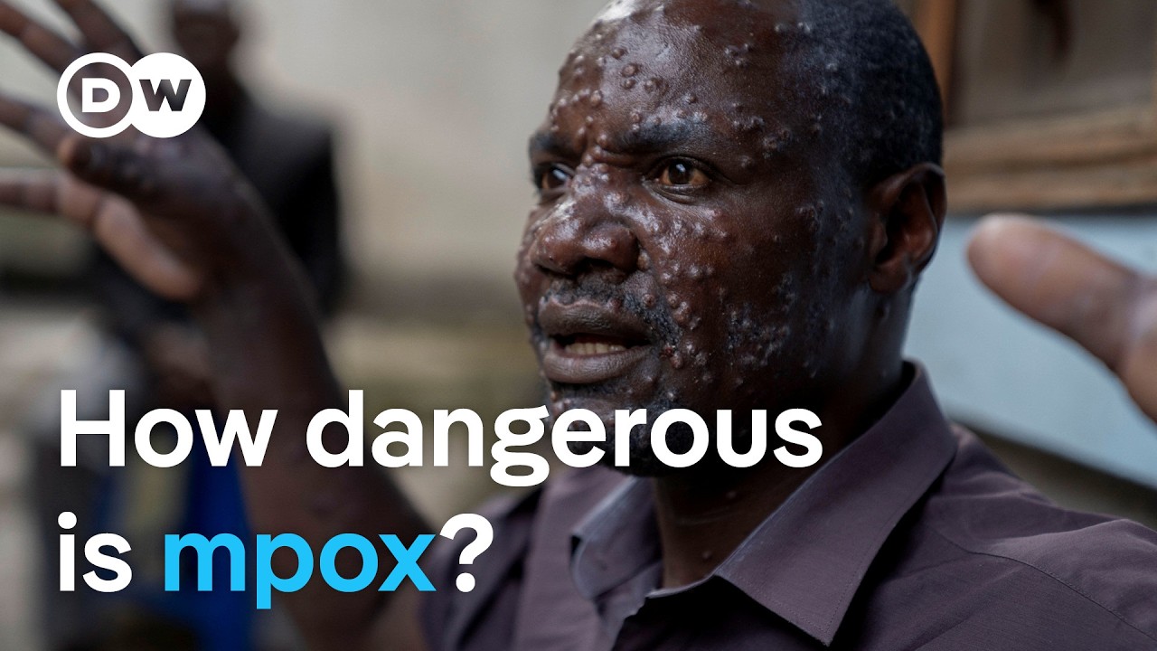 New mpox virus: Why is it spreading so quickly    DW News