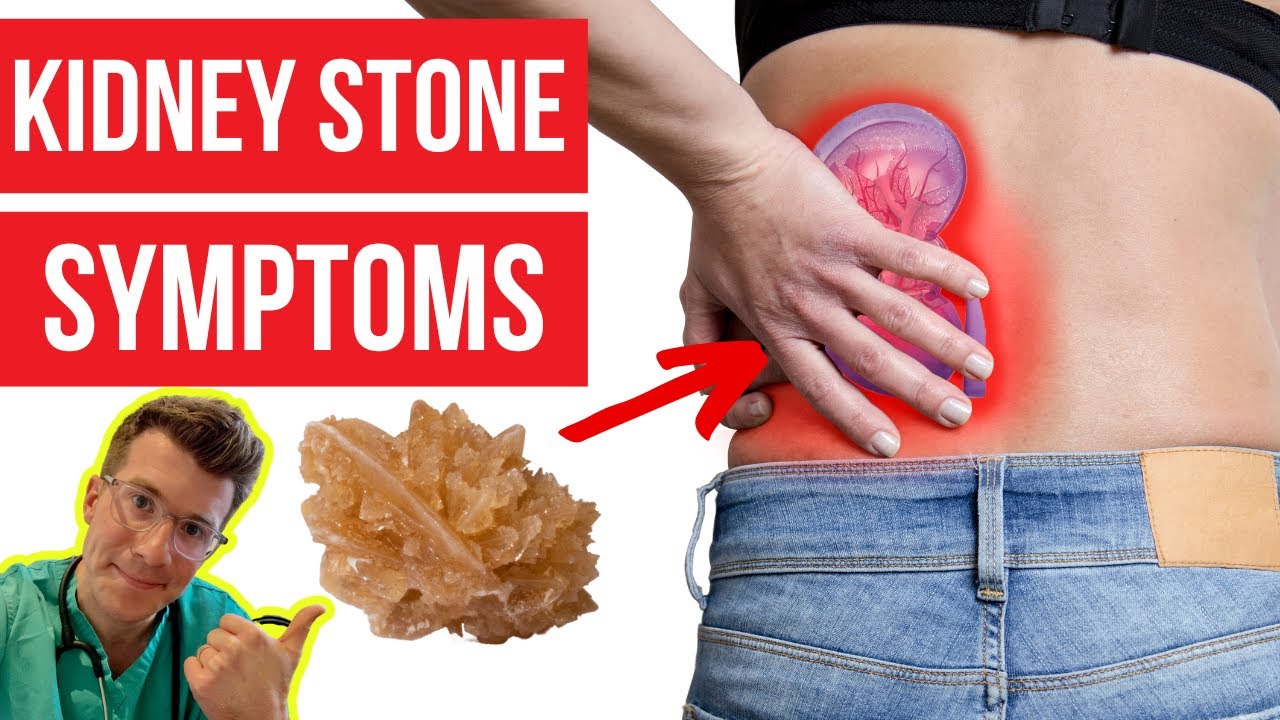 WHAT SYMPTOMS DO KIDNEY STONES CAUSE? DOCTOR EXPLAİNS...PLUS HOW KİDNEY STONES ARE DİAGNOSED  MORE!