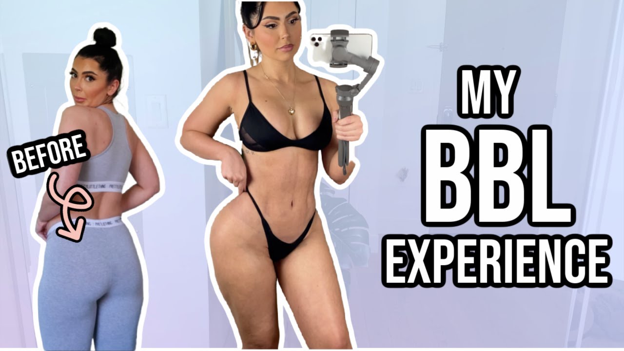 MY BBL IN MIAMI ♡ DOCTOR, RECOVERY HOME, COMPLICATIONS, PACKING TIPS + MORE!