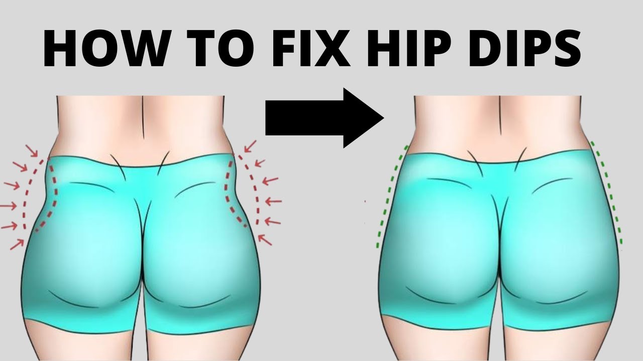 From Dips to Hips! QA with Dr Rosh on Hip Dip Filler