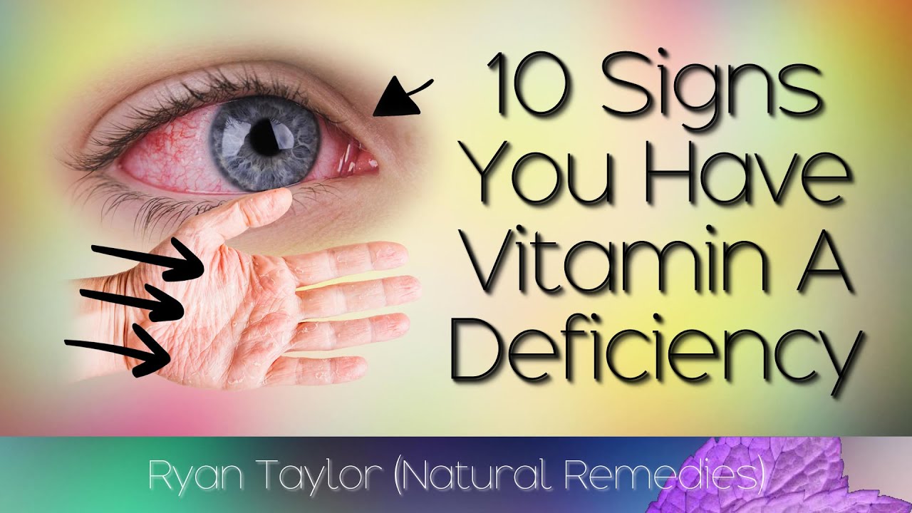 10 Common Signs of Vitamin A Deficiency