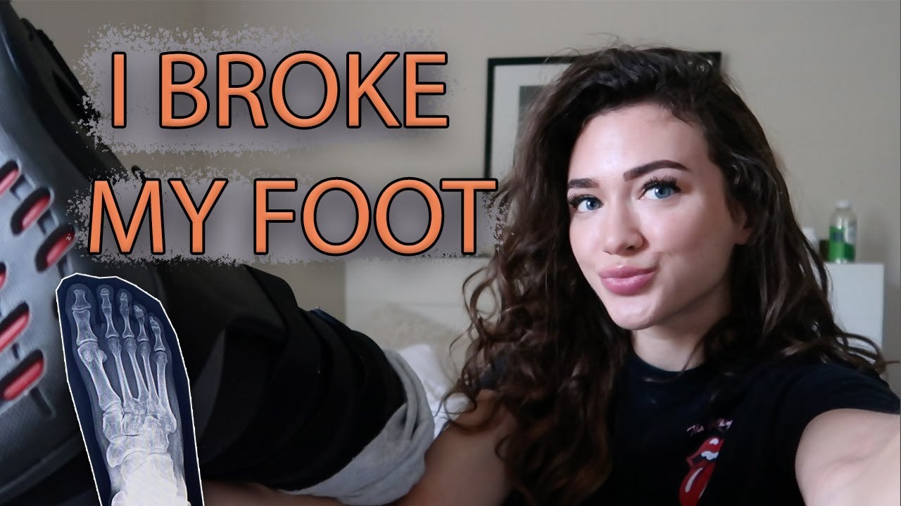 I BROKE MY FOOT | Working Out While Injured | Lisfranc (Evgeniya Lvovna)