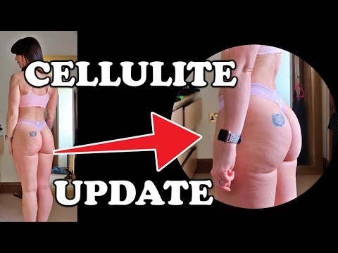 CELLULİTE UPDATE | TOP 5 HAMSTRİNG EXERCİSES | MUSCLEFOOD HAUL