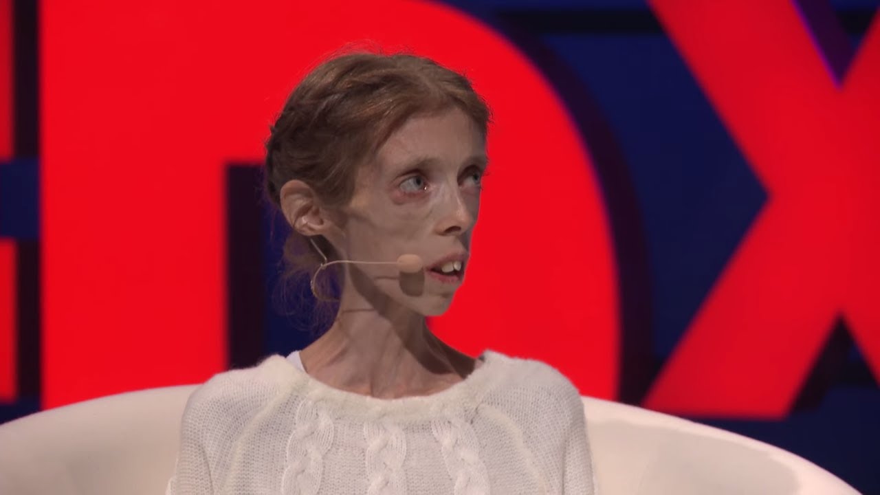 NOSTALGİA | LENE MARİE FOSSEN  MORTEN KROGVOLD | TEDXARENDAL