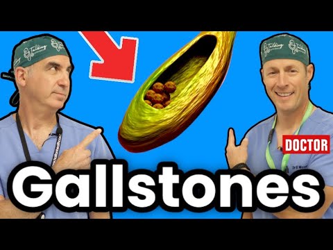 HOW TO GET RİD OF GALLSTONES AND CHOLECYSTİTİS
